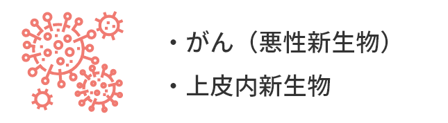 がん（悪性新生物）。上皮内新生物