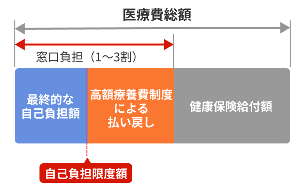 高額療養費制度の適用イメージ。医療費総額のうち、窓口負担（1～3割）が自己負担限度額までの「最終的な自己負担額」と、超過分の「高額療養費制度による払い戻し」に分かれる仕組みを示しています。